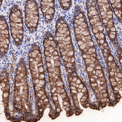 Galectin-3 Recombinant Rabbit mAb (SDT-370-111)