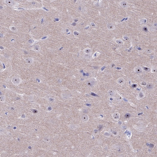 IκBα Recombinant Rabbit mAb (SDT-457-9)