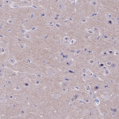 IκBα Recombinant Rabbit mAb (SDT-457-9)