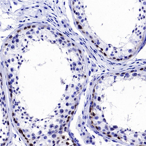 LIN28B Recombinant Rabbit mAb (S-2360-117)