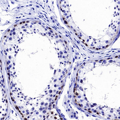 LIN28B Recombinant Rabbit mAb (S-2360-117)