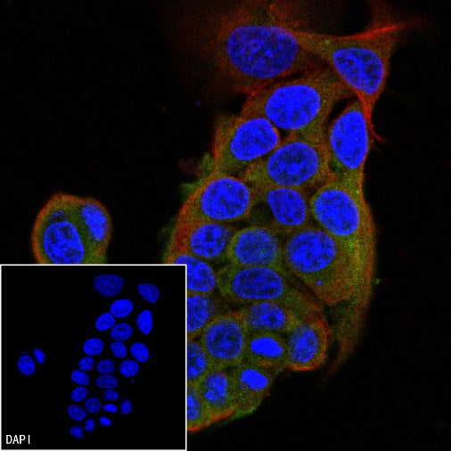 Phospho-ULK1 (Ser757) Recombinant Rabbit mAb (S-3495)