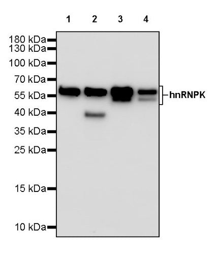 hnRNPK Recombinant Rabbit mAb (S-1645-45)