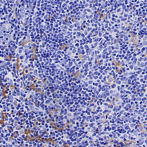 CSF-1R Recombinant Rabbit mAb (S-467-26)