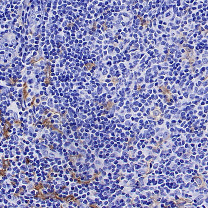 CSF-1R Recombinant Rabbit mAb (S-467-26)