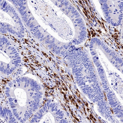 VISTA Recombinant Rabbit mAb (S-1469-72)
