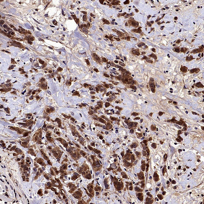 Phospho-eIF4E (Ser209) Recombinant Rabbit mAb (S-2652-195)