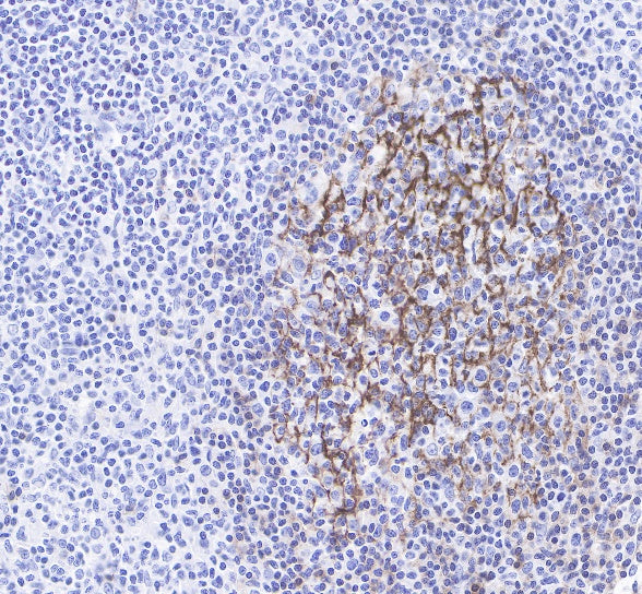 S-RMab® CD23 Recombinant Rabbit mAb (SDT-028-67)