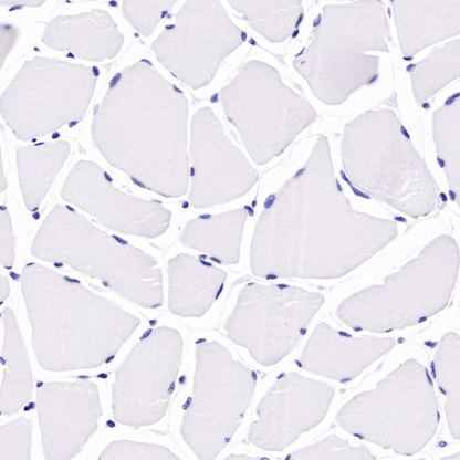 Antibody Diluent