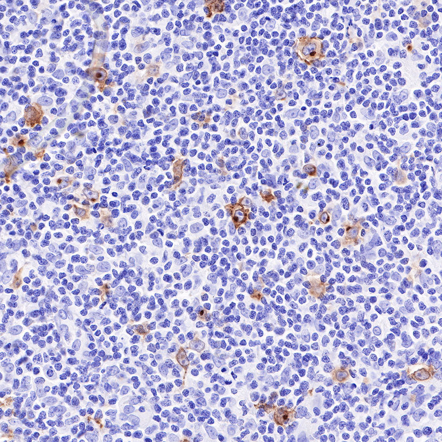CD30 Recombinant Rabbit mAb (SDT-216-2)