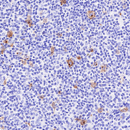 CD30 Recombinant Rabbit mAb (SDT-216-2)
