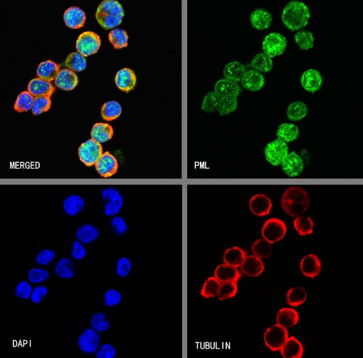 PML Recombinant Rabbit mAb (S-1908-60)