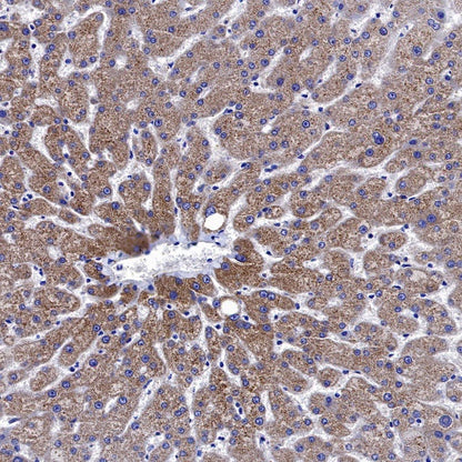 Neuropilin 1 Recombinant Rabbit mAb (S-1453-6)