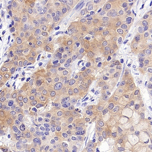 INPP4B Recombinant Rabbit mAb (S-3210-62)
