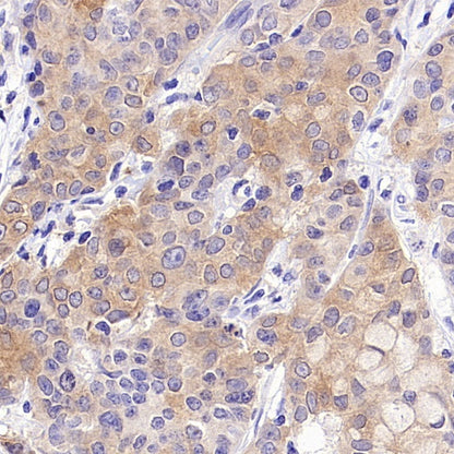 INPP4B Recombinant Rabbit mAb (S-3210-62)