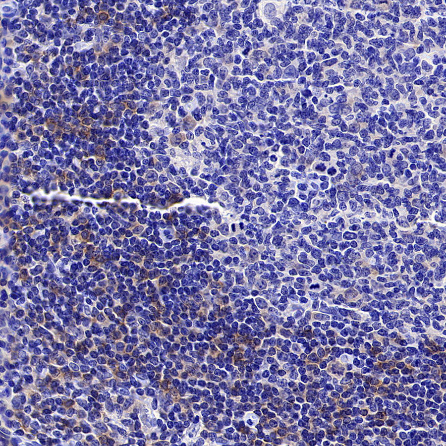 CD1c Recombinant Rabbit mAb (S-5242)