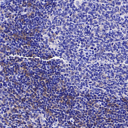 CD1c Recombinant Rabbit mAb (S-5242)