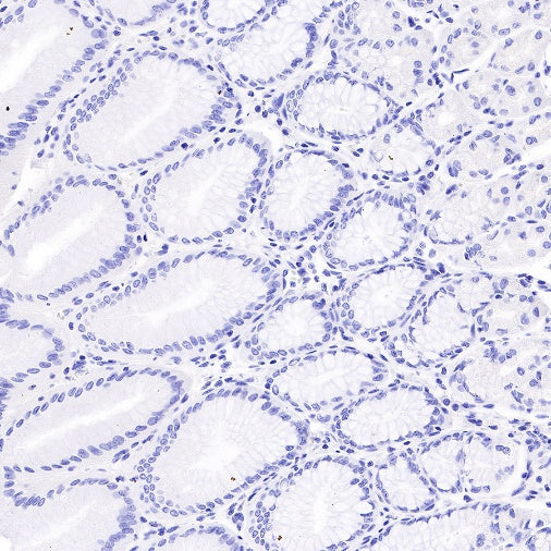 TSHB Recombinant Rabbit mAb (S-537-52)