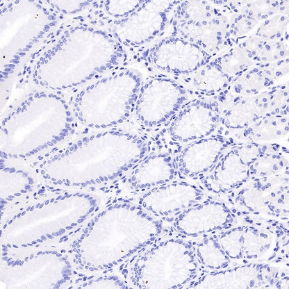 TSHB Recombinant Rabbit mAb (S-537-52)