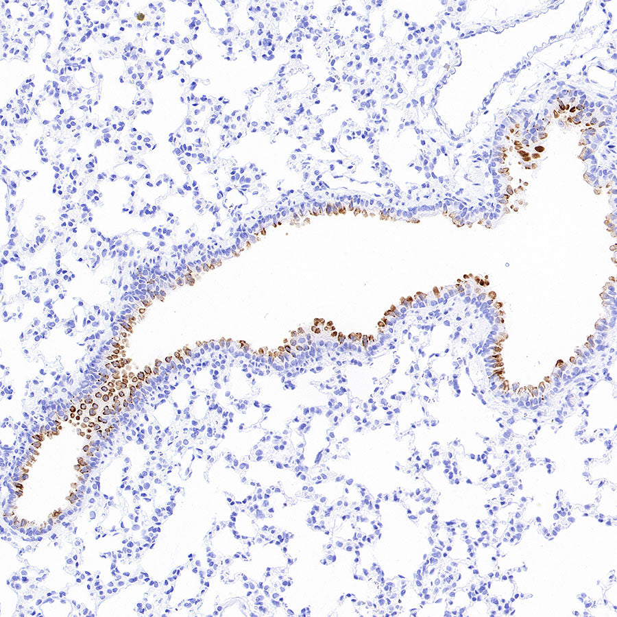 Uteroglobin Recombinant Rabbit mAb (S-6021)