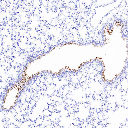Uteroglobin Recombinant Rabbit mAb (S-6021)