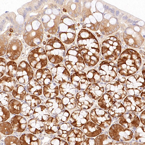 IMPDH2 Rabbit Polyclonal Antibody