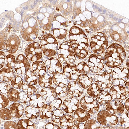 IMPDH2 Rabbit Polyclonal Antibody