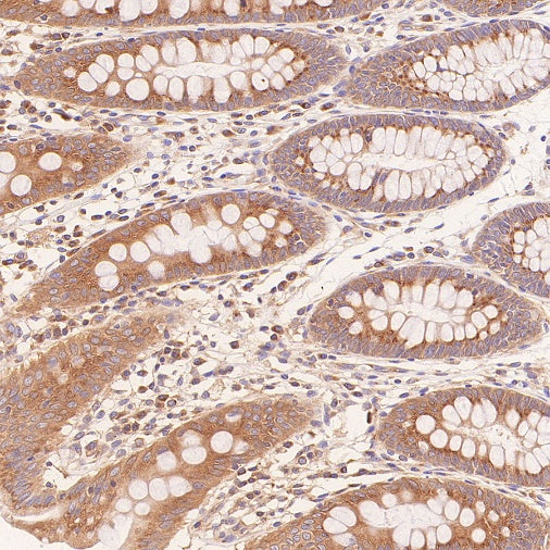 Glycogen Synthase Recombinant Rabbit mAb (S-2698-24)