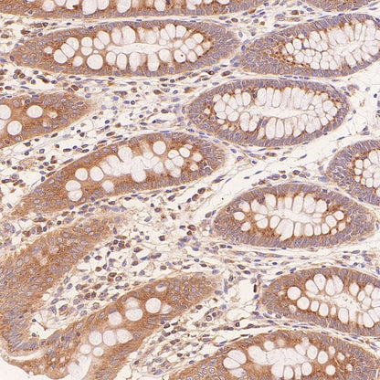 Glycogen Synthase Recombinant Rabbit mAb (S-2698-24)