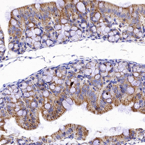 SDHB Recombinant Rabbit mAb (SDT-1162-2)