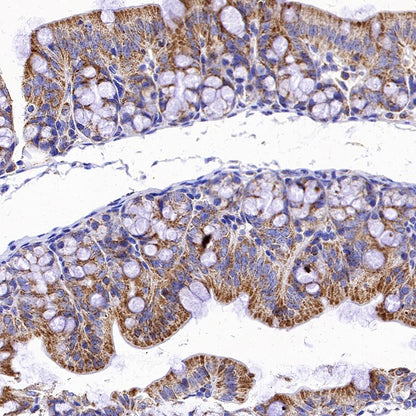 SDHB Recombinant Rabbit mAb (SDT-1162-2)