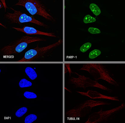 PARP1 Recombinant Rabbit mAb (S-R299)