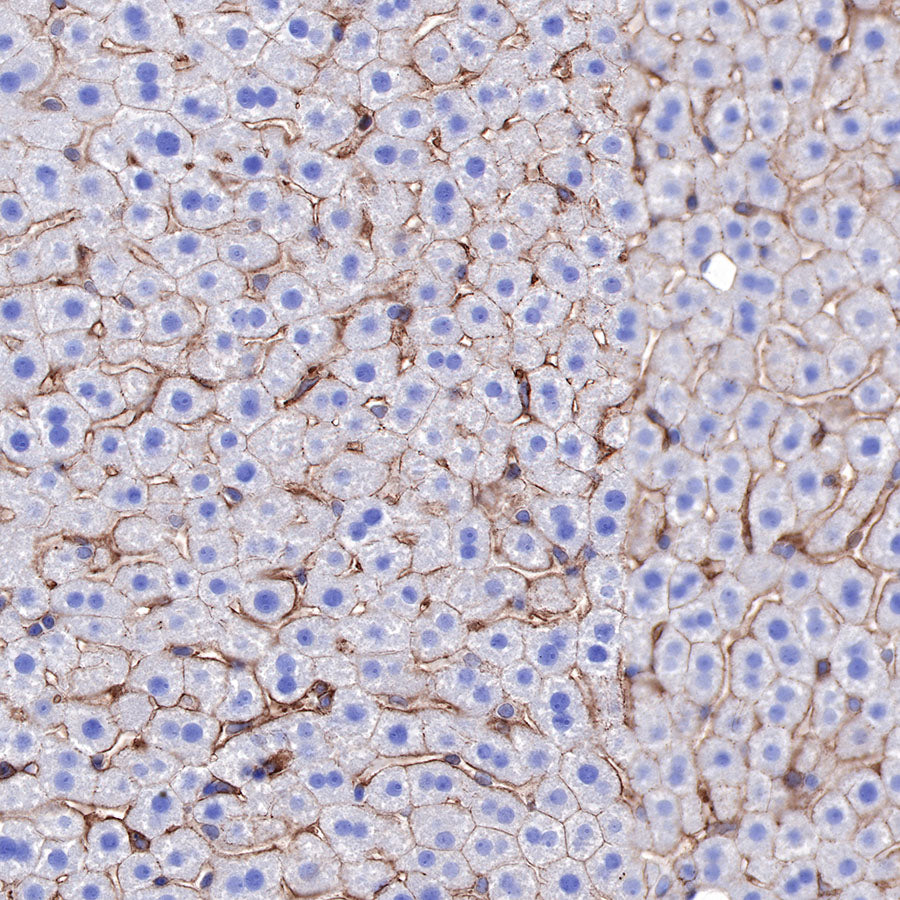 α-Actinin-1 Recombinant Rabbit mAb (SDT-311-20)