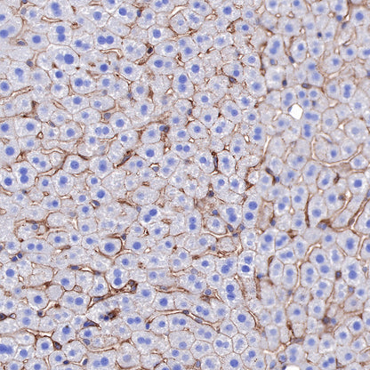 α-Actinin-1 Recombinant Rabbit mAb (SDT-311-20)