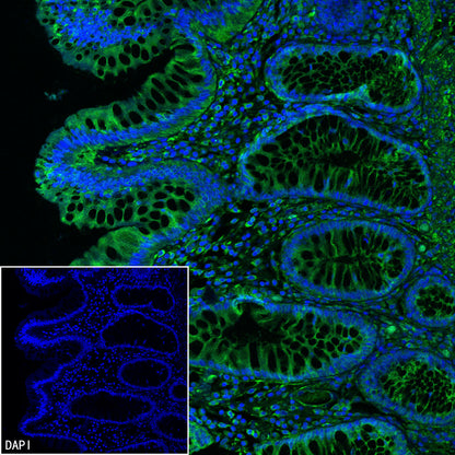 Vinculin Recombinant Rabbit mAb (S-5405)