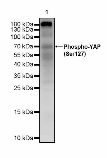 Phospho-YAP (Ser127) Recombinant Rabbit mAb (S-4250)