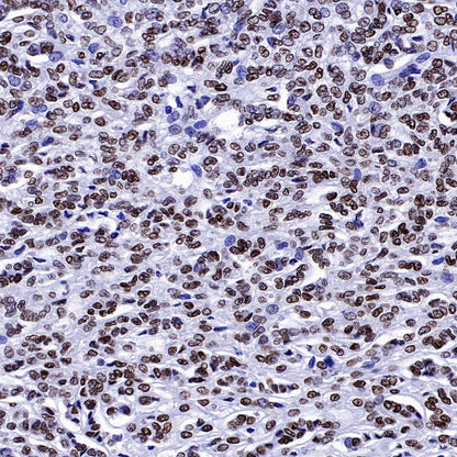 FOXL2 Recombinant Rabbit mAb (SDT-557-361)