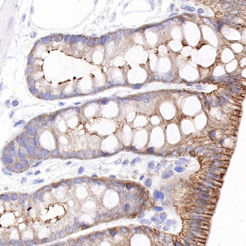 COX2 Recombinant Rabbit mAb (S-870-18)