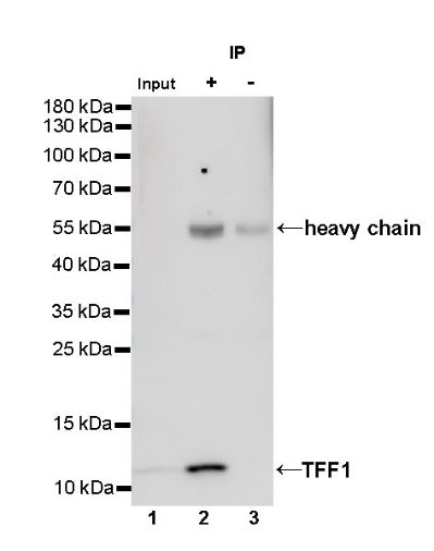 TFF1 Recombinant Rabbit mAb (S-481-16)