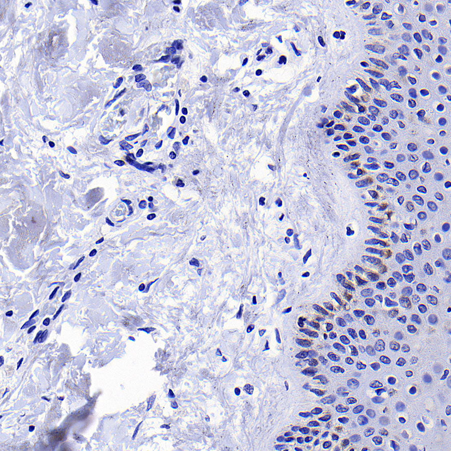 KLK5 Recombinant Rabbit mAb (S-4238-55)