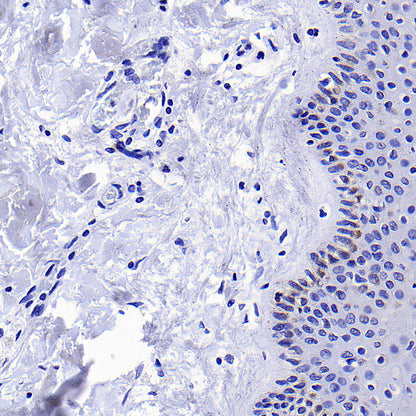 KLK5 Recombinant Rabbit mAb (S-4238-55)