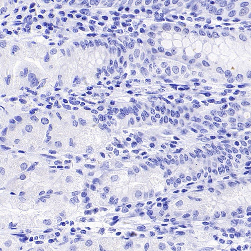 TMEM16A Recombinant Rabbit mAb (SDT-2179-12)