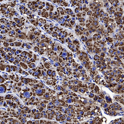 Hepatocyte Specific Antigen Recombinant Mouse mAb (SDT-4389)