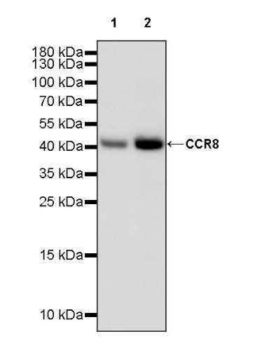 CCR8 Recombinant Rabbit mAb (S-1414-148)