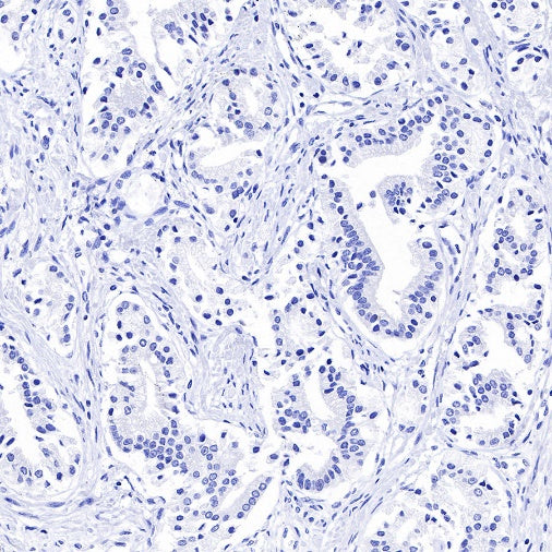 TRPS1 Recombinant Rabbit mAb (S-765-3)