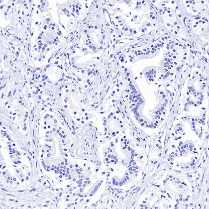 TRPS1 Recombinant Rabbit mAb (S-765-3)