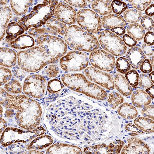 ATP5B Recombinant Rabbit mAb (S-1271-29)