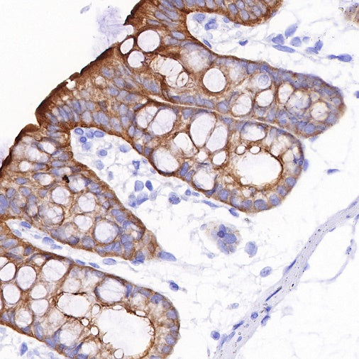 Villin Recombinant Rabbit mAb (SDT-R255)