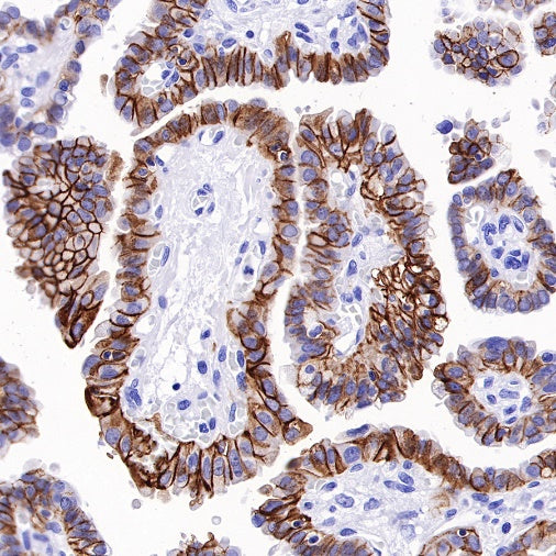 TACSTD2/TROP2 Recombinant Rabbit mAb (S-R237)