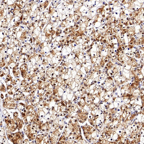 ACLY/ATP citrate lyase Recombinant Rabbit mAb (S-2025-32)
